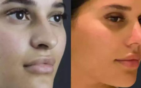 Rhinoplasty in Dubai: Best Practices for Long-Term Results