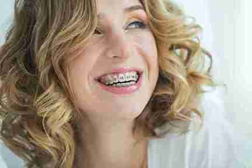 That Fresh, Bright Smile Feeling Starts in Merthyr Tydfil