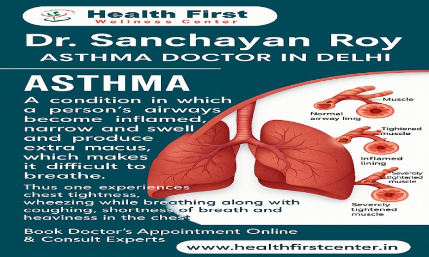 Expert Asthma Specialist Doctor Near Me for Long-Term Care: Dr. Sanchayan Roy