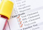 Best Blood Test at Home Kits for Cholesterol