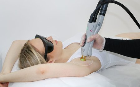 Why Your Laser Hair Removal Might Not Be Working Well