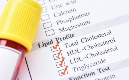Best Blood Test at Home Kits for Cholesterol