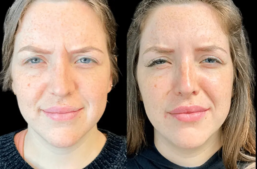 Stay Youthful Naturally with the Best Aesthetic Clinic in Dubai