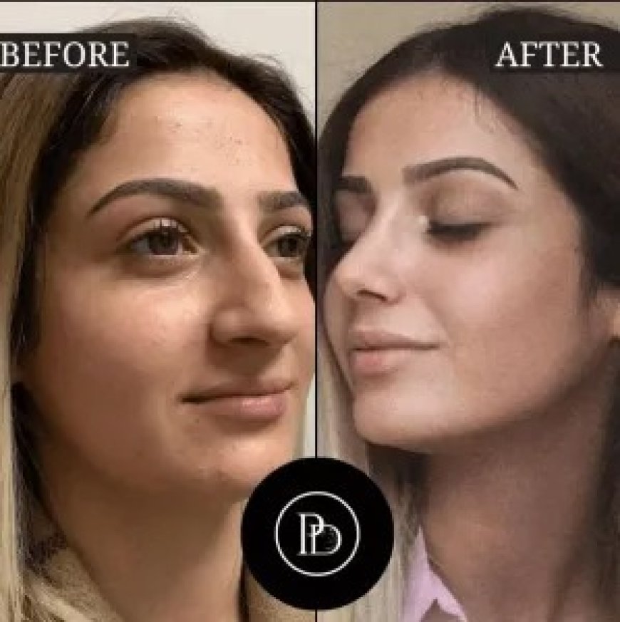PRP Treatment in Dubai: Who Is It For and What to Expect