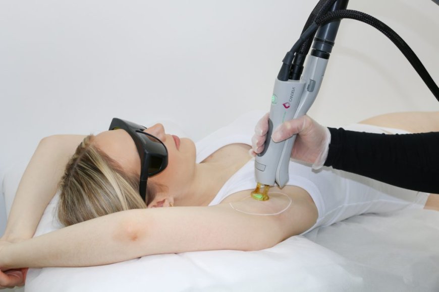 Why Your Laser Hair Removal Might Not Be Working Well