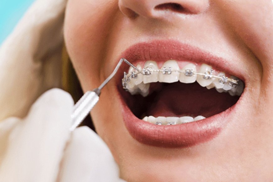 Dentist Frisco – Personalized Dental Care for Every Smile