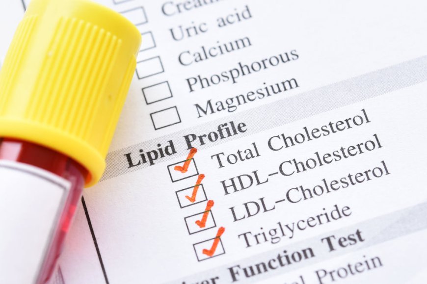 Best Blood Test at Home Kits for Cholesterol